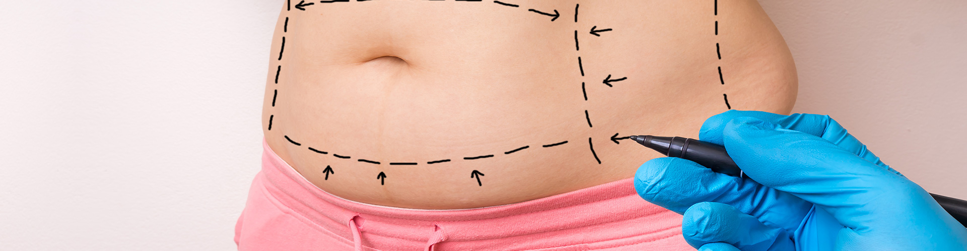 Banner Fettwegspritze Banner Fettwegspritze