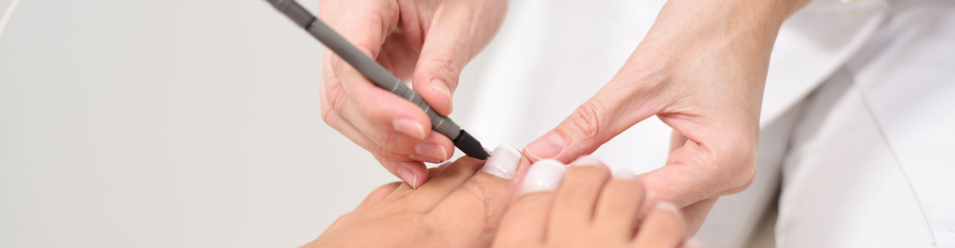 Pinpointe Nagellaser Pinpointe Nagellaser