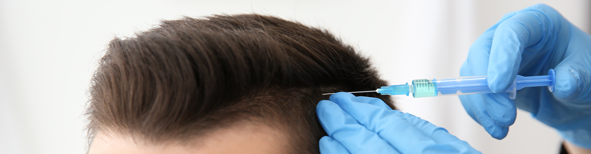 Haartransplantation Haartransplantation